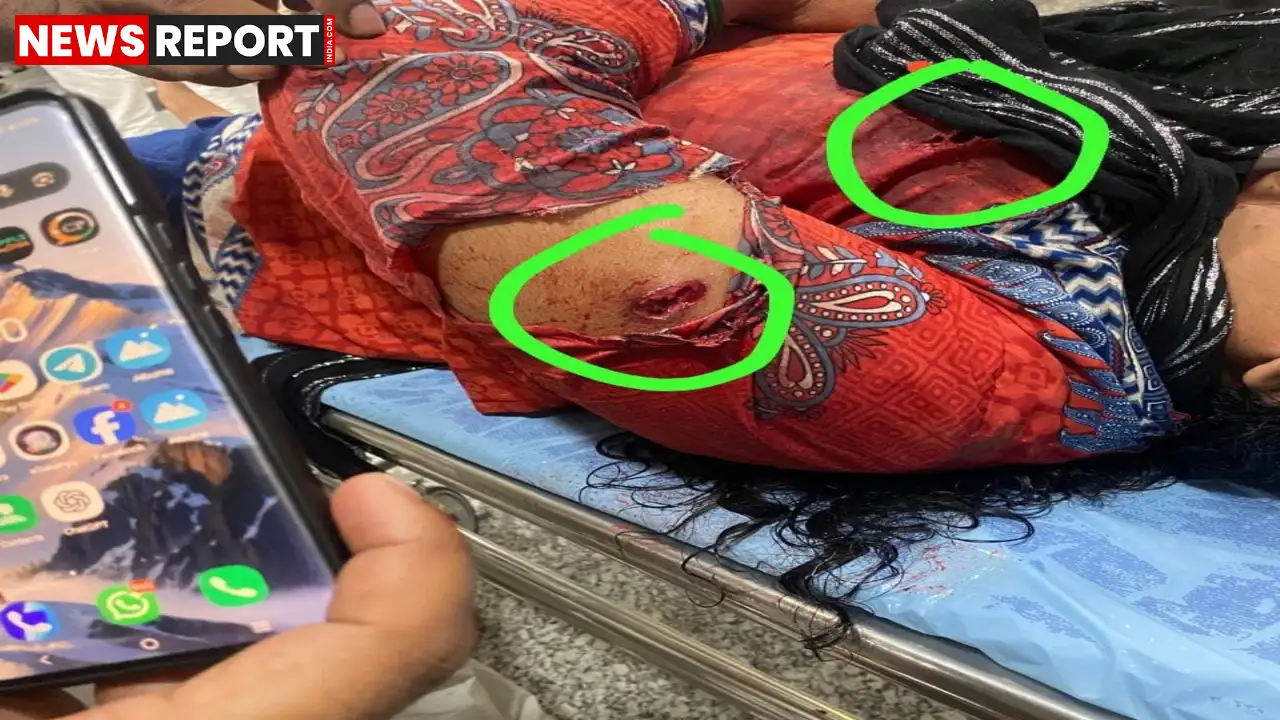 चंदौली: घर में लूटपाट का विरोध करने पर महिला को बदमाशों ने मारी गोली, हालत गंभीर चंदौली: घर में लूटपाट का विरोध करने पर महिला को बदमाशों ने मारी गोली, हालत गंभीर