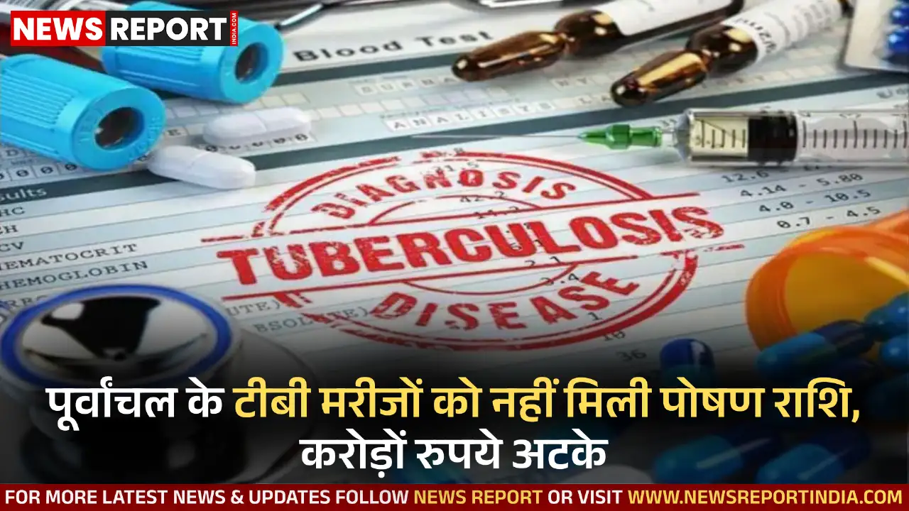 पूर्वांचल के टीबी मरीजों को नहीं मिली पोषण राशि, करोड़ों रुपये अटके पूर्वांचल के टीबी मरीजों को नहीं मिली पोषण राशि, करोड़ों रुपये अटके