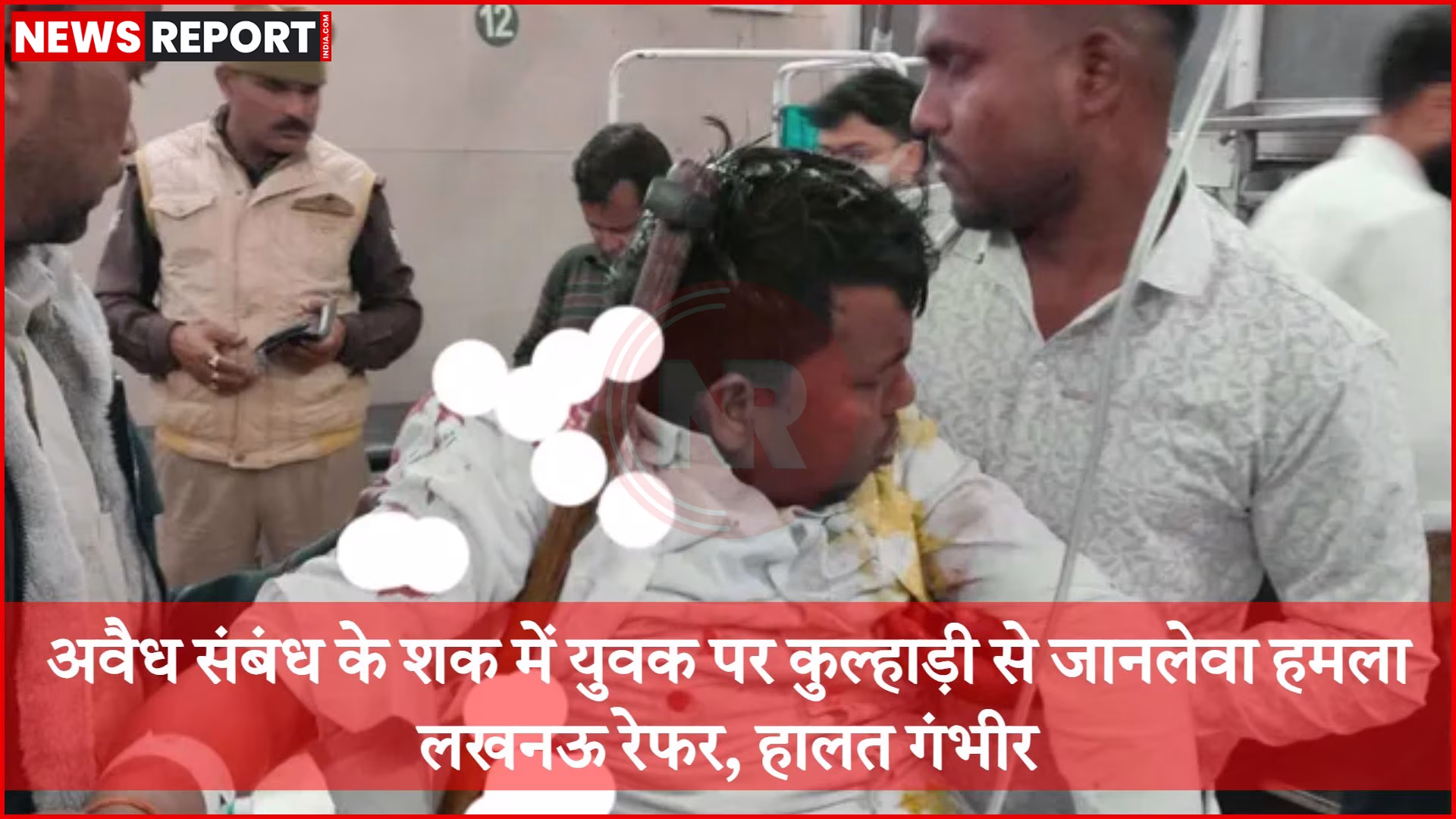 एक व्यक्ति के सिर पर कुल्हाड़ी से हुए हमले के बाद खून बह रहा है, वह अस्पताल में भर्ती है।