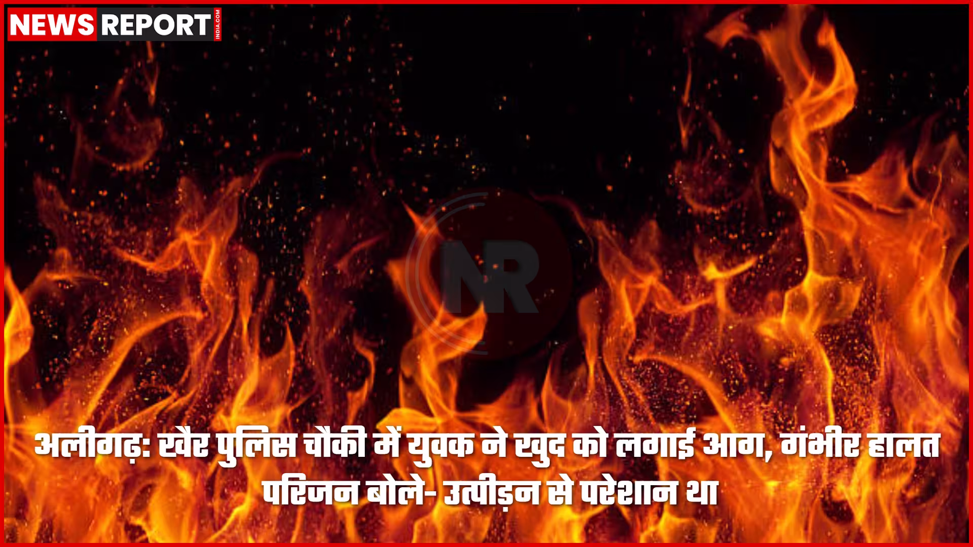 अलीगढ़ के खैर पुलिस चौकी में आग से झुलसा युवक मनोज वर्मा