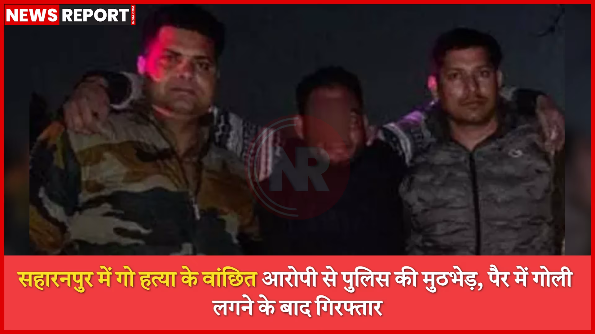 पुलिस मुठभेड़ में घायल गो हत्या का आरोपी रागिब अस्पताल में, पुलिसकर्मी निगरानी करते हुए।