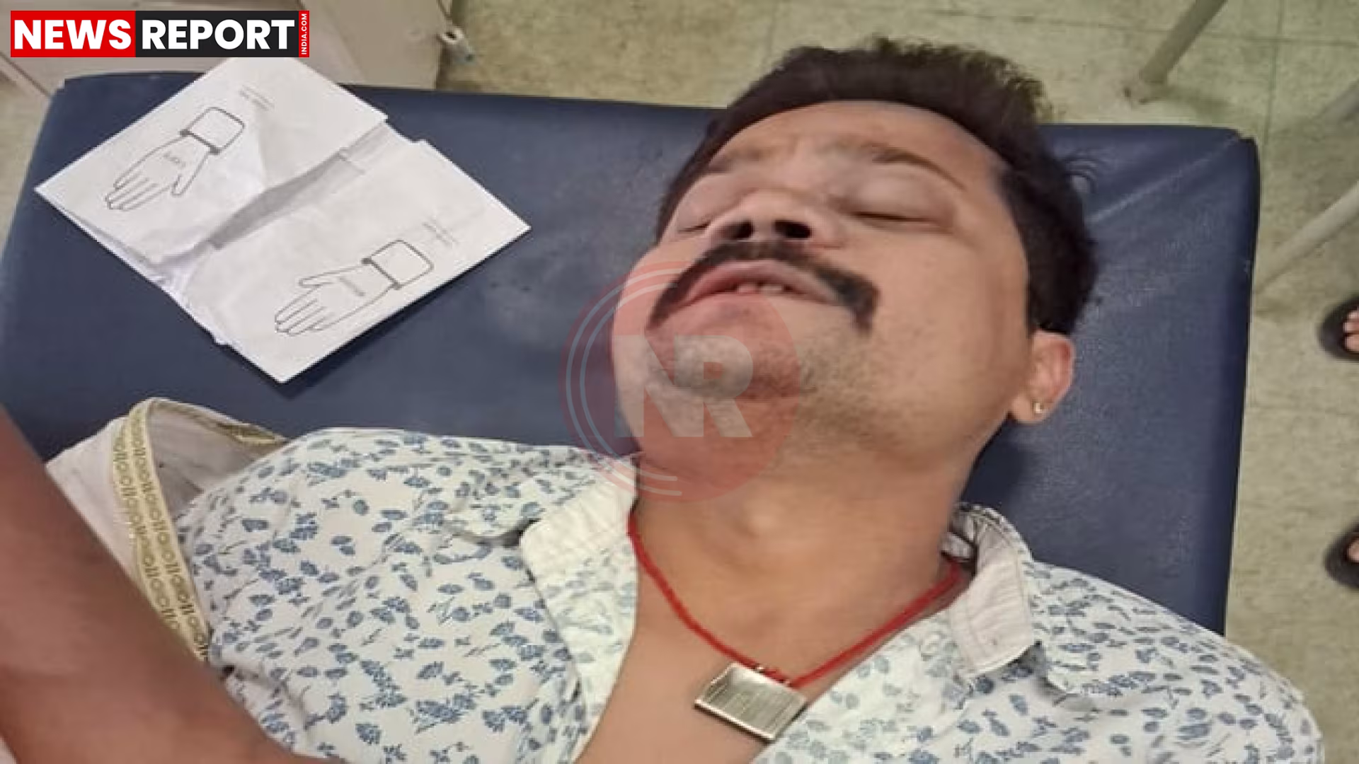 अस्पताल में इलाज करा रहे घायल भाजपा नेता पम्मी गोस्वामी की प्रतीकात्मक तस्वीर