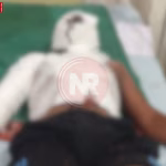 वाराणसी में एसिड हमले के घटनास्थल का निरीक्षण करती पुलिस टीम