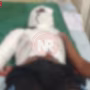 वाराणसी में एसिड हमले के घटनास्थल का निरीक्षण करती पुलिस टीम