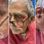 बीएचयू अस्पताल के आईसीयू में भर्ती पद्मश्री प्रो. टीके लहरी